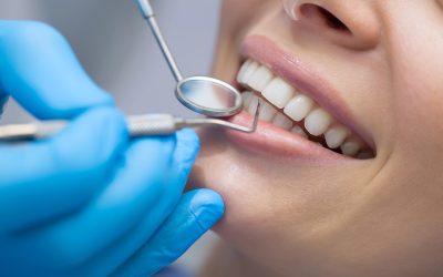 How Often Should You Visit the Dentist for Optimal Oral Health?