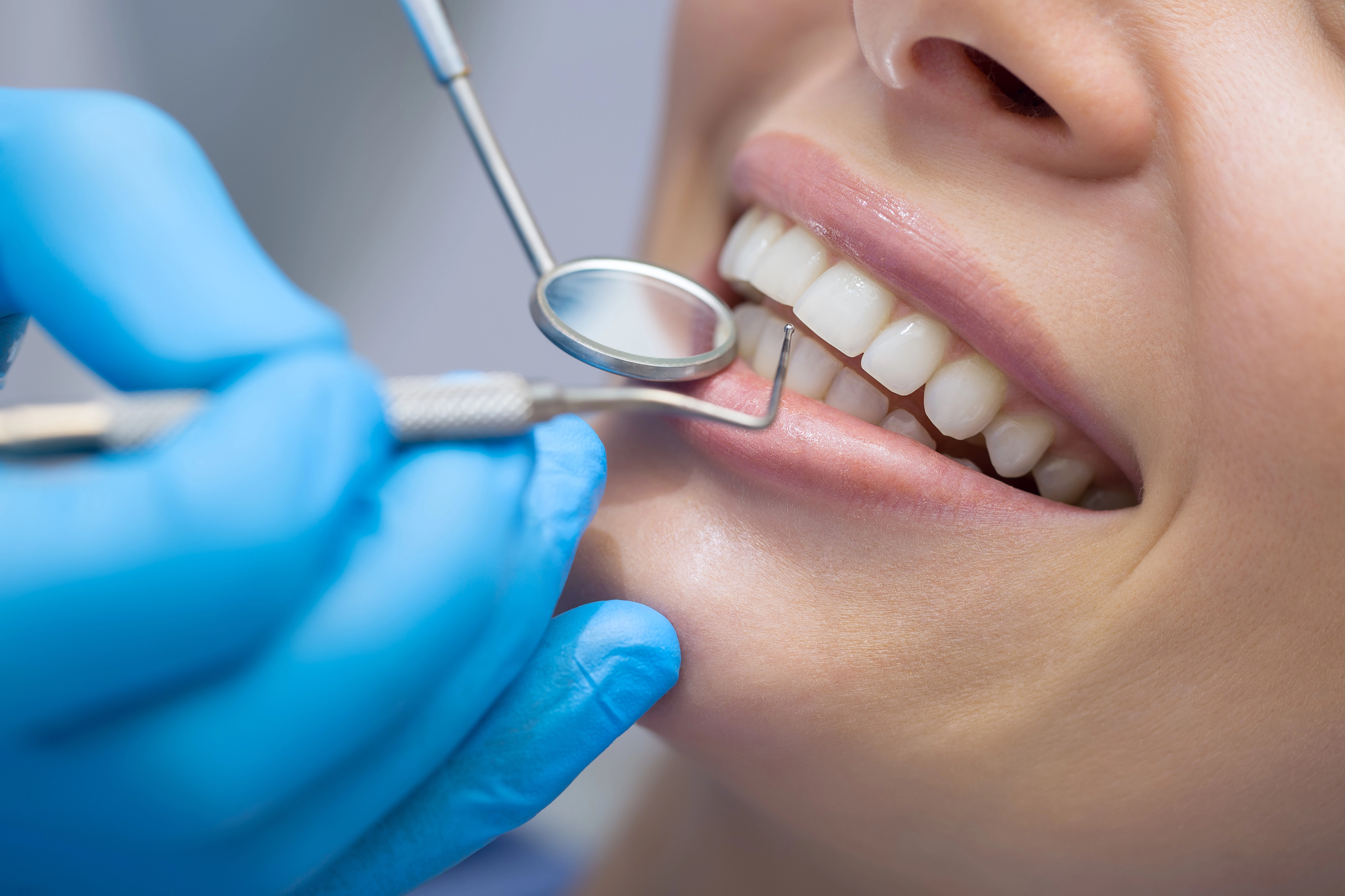 Woman with healthy teeth during a dental checkup.